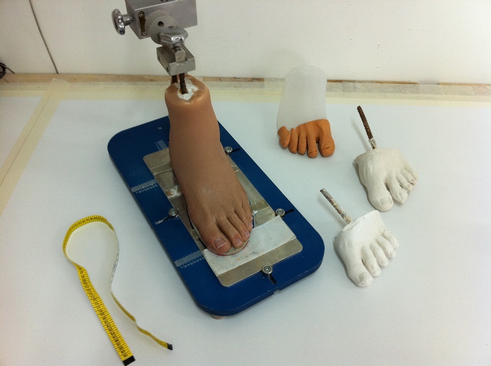 Ankle and Foot Prostheses