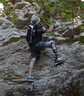 Η Ζωή Μετά τον Ακρωτηριασμό: Η Ανάγκη για Ψυχολογική Υποστήριξη