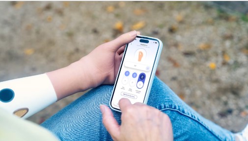 SPEEDHAND OTTOBOCK: Καινοτομία και Λειτουργικότητα στην Προσθετική Άνω Άκρου