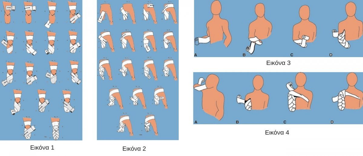 Postoperative Rehabilitation of Amputation