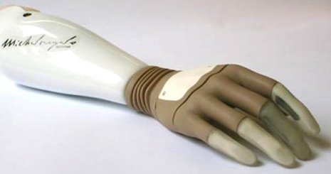 Forearm and Hand Prosthetics