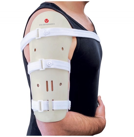 Humeral diaphyseal fracture splint \